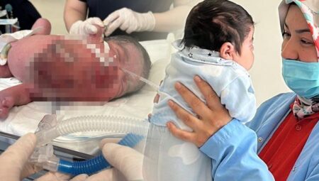 Eymen bebek dünyada 7’inci hadise olarak tarihe geçti: Yaşama bahtı yoktu