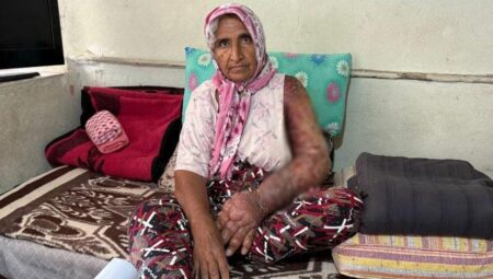 Her şey 8 yıl evvel başladı! Kolu şişti, bedenine kadar yayıldı