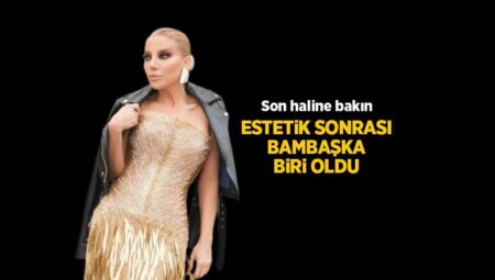 Bıçak altına yatan Gülşah Saraçoğlu değişik biri oldu! Estetik sonrası son haline bakın