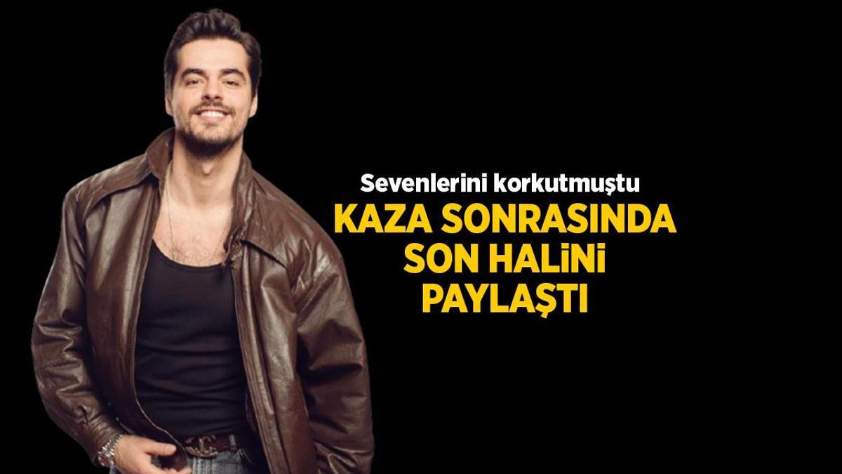 Taburcu olduktan sonra bir ilk! Berk Atan son halini paylaştı